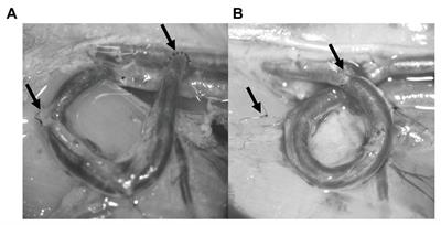 Micro-Rheological Changes of Red Blood Cells in the Presence of an Arterio-Venous Fistula or a Loop-Shaped Venous Graft in the Rat